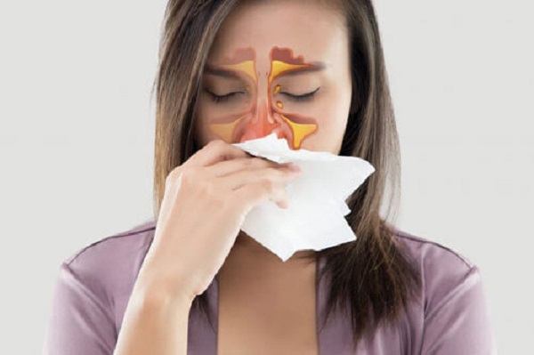 Nghẹt mũi & Những mẹo trị nghẹt mũi hiệu quả, an toàn